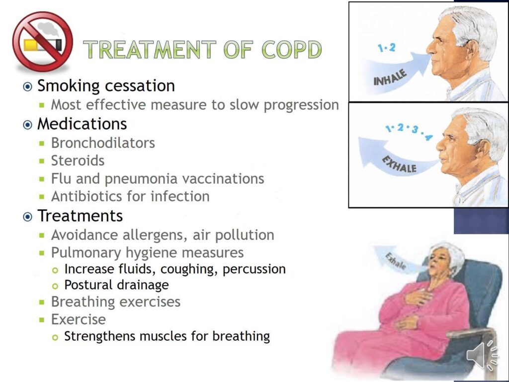 Pulmonary Hygiene for Easier Breathing